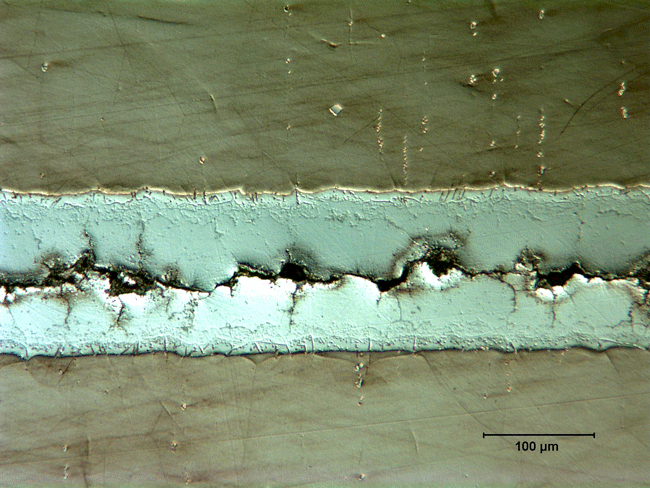 Fig. 4 Failure in service of nickel-brazed joint with poor gap- clearance control