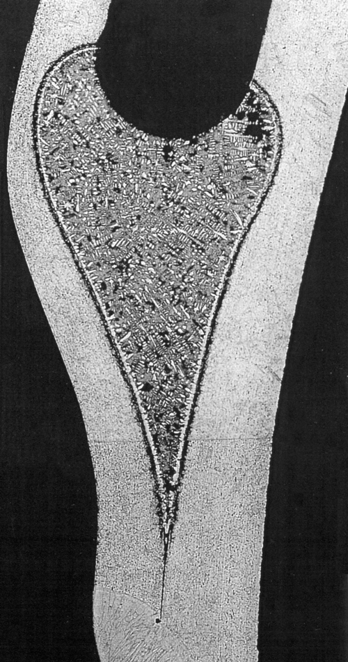 Fig. 1 -- Nickel-based BFM eroding (dissolving, i.e., eating through) two stainless hi-temp alloy sheets, when held at brazing temp of 2200F (1200C) for 15-minutes.