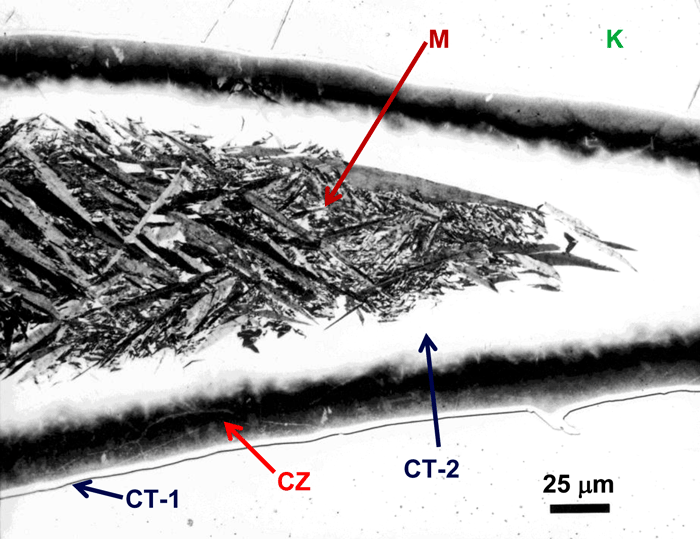 Figure 11:  A large patch of taenite, surrounded by kamacite (K), containing a thin outer layer of “clear” (retained) taenite (CT-1), a dark etching “cloudy zone” (CZ), an inner region of “clear” (retained) taenite (CT-2) and martensite (M) in the central region in the Canyon Diablo meteorite, a coarse octahedrite that fell in Arizona (etched with 2% nital, 400X).